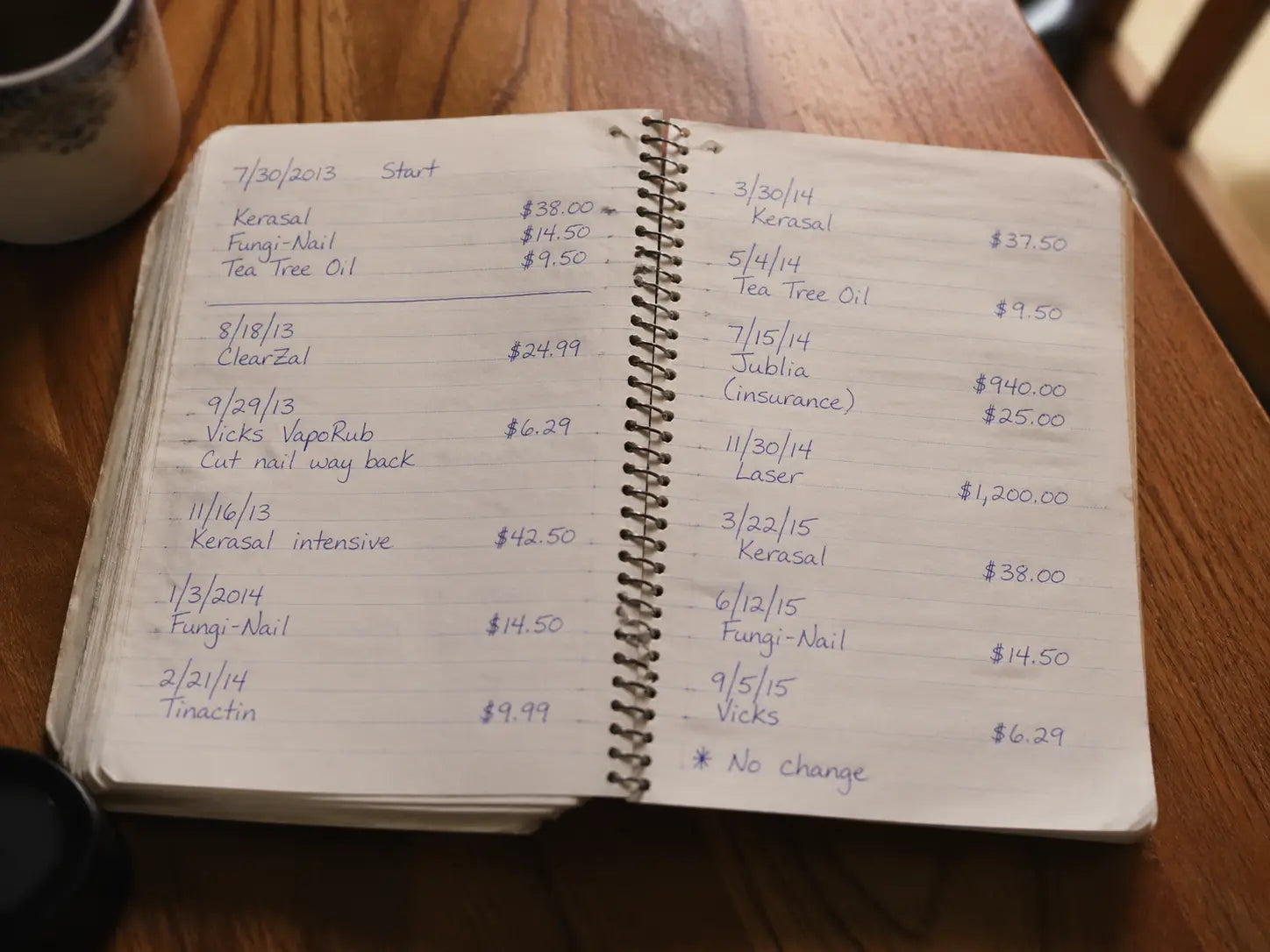 Close-up of a spiral-bound notebook with handwritten treatment names and dollar amounts in blue ballpoint pen.