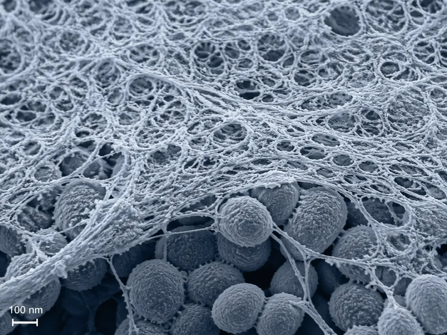 High-magnification electron microscopy visualization of a fungal biofilm mesh covering fungal cells.